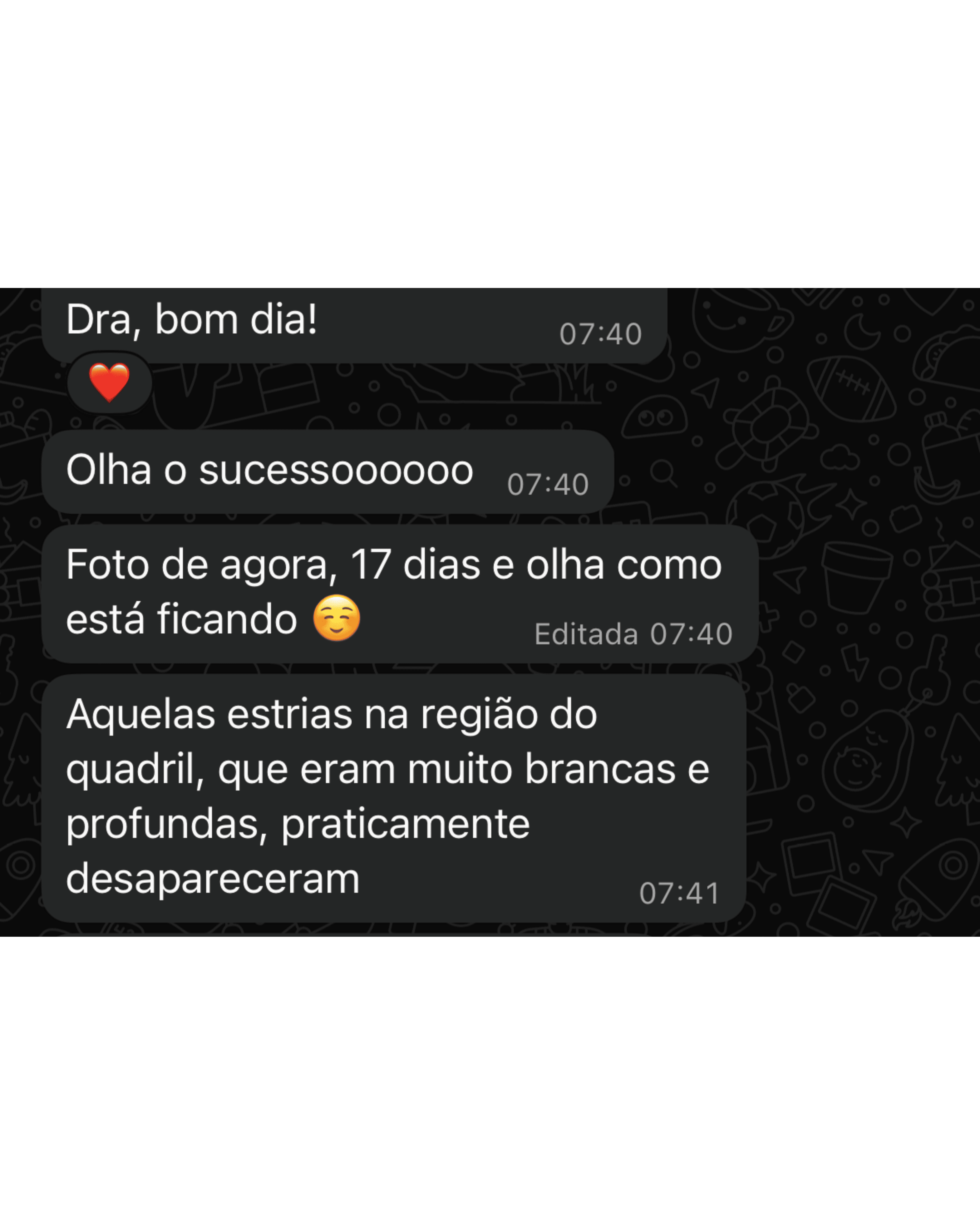 Depoimento de cliente satisfeita com o tratamento Indérmis