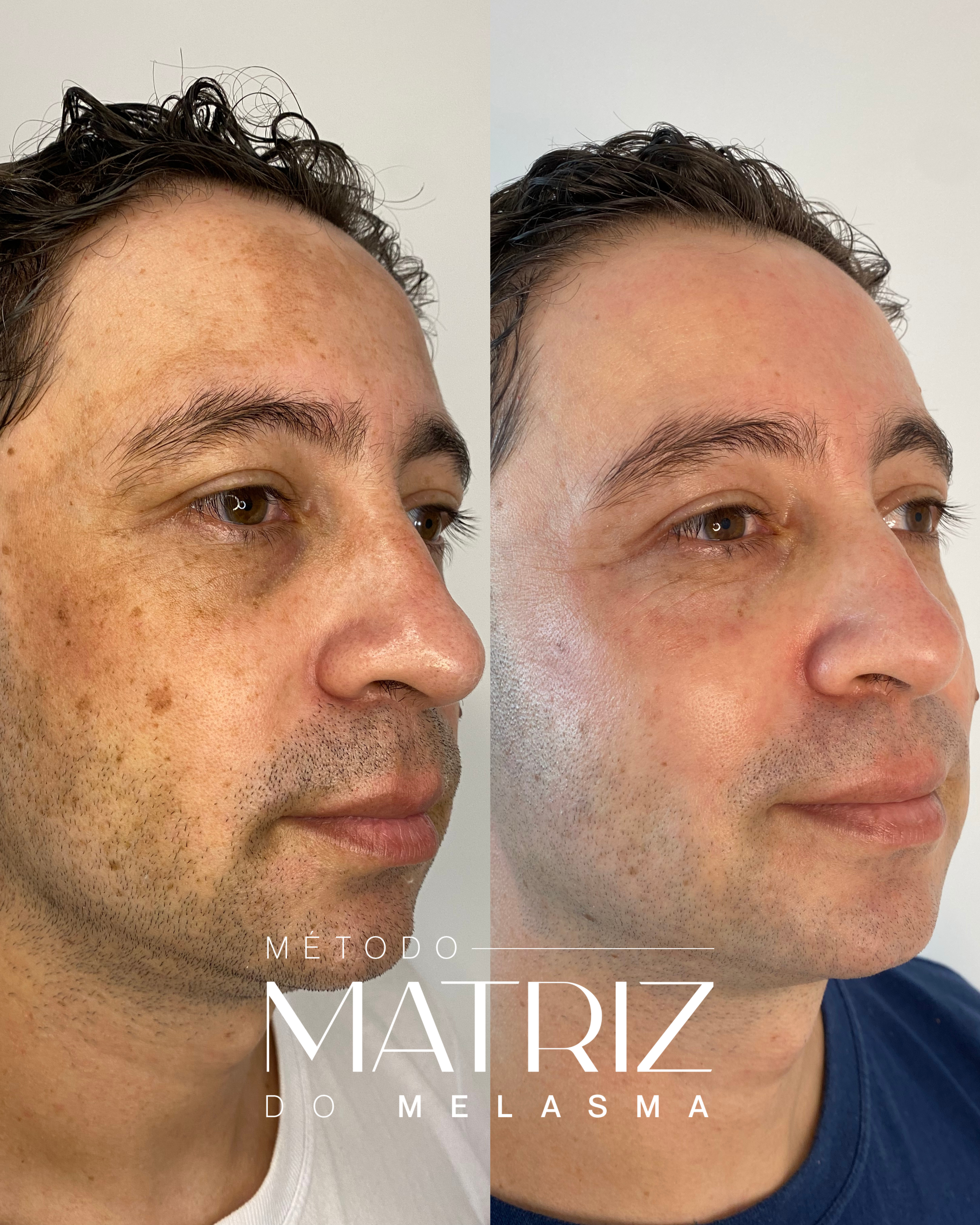 Nicole Carvalho — Biomédica e Expert em Melasma